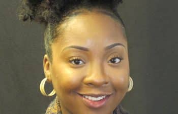 Patient after Invisalign treatment.