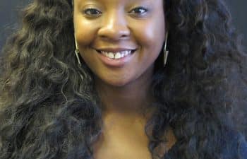 Patient before Invisalign treatment.