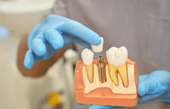 Tooth Replacement Can Restore Your Smile