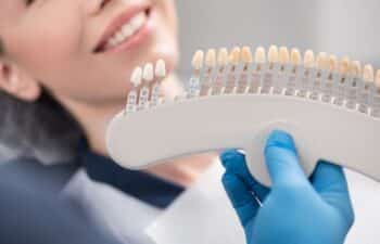 Dentist holding shade guide with tooth color samples for veneer selection and smile design.