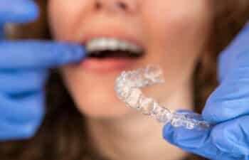 Invisalign-Treatment-Marietta