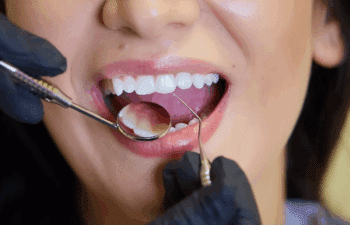 Questions to Ask at Your Dental Checkup in Marietta GA