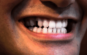 skilled cosmetic dentist