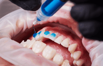 Cosmetic Dentistry Solutions