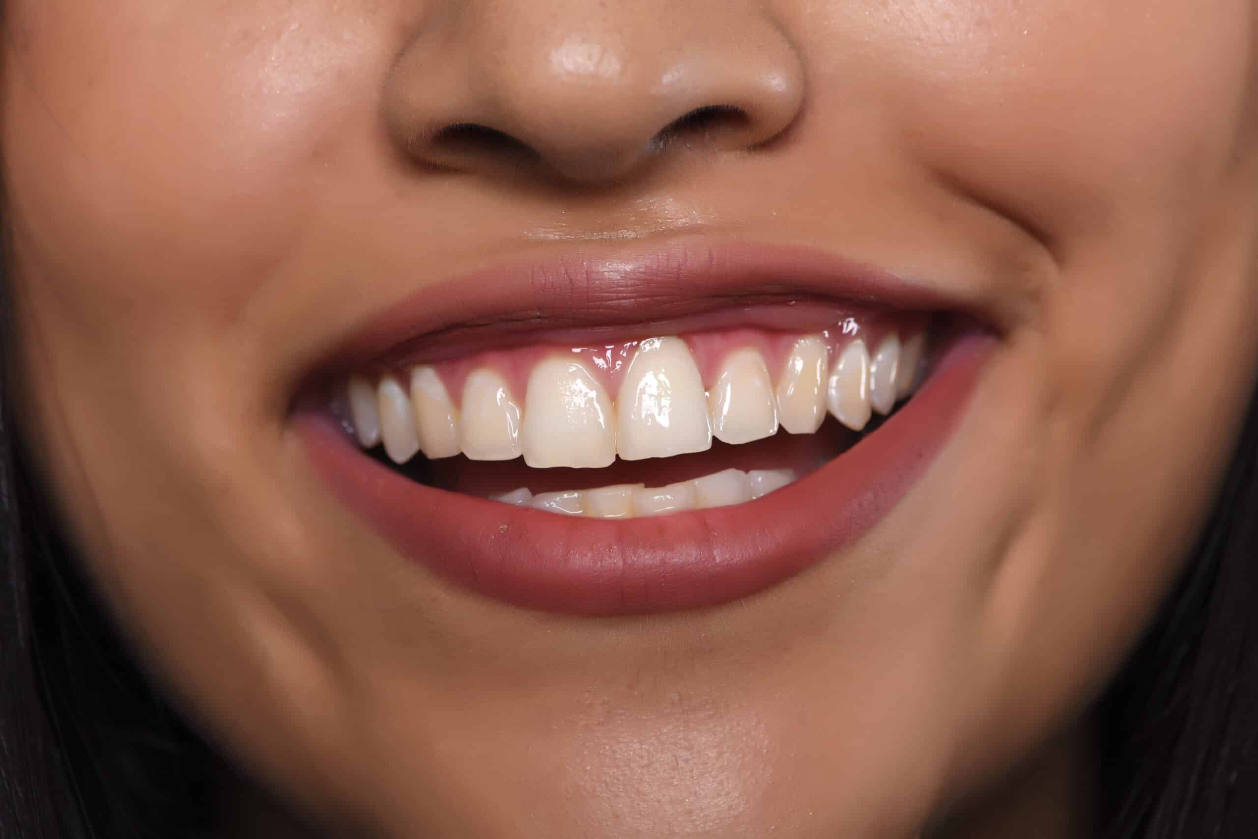 Will Your Gum Disease Treatment Actually Last Five Years